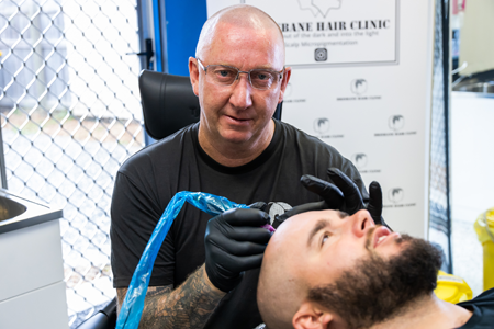 Scalp Micro Pigmentation at Brisbane Hair Clinic